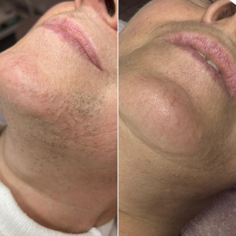 Zdjęcie WhatsApp 2025-09-15 o 13.50.11_0a315ffd