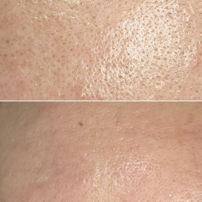 Zdjęcie WhatsApp 2025-09-15 o 13.50.11_439ac904