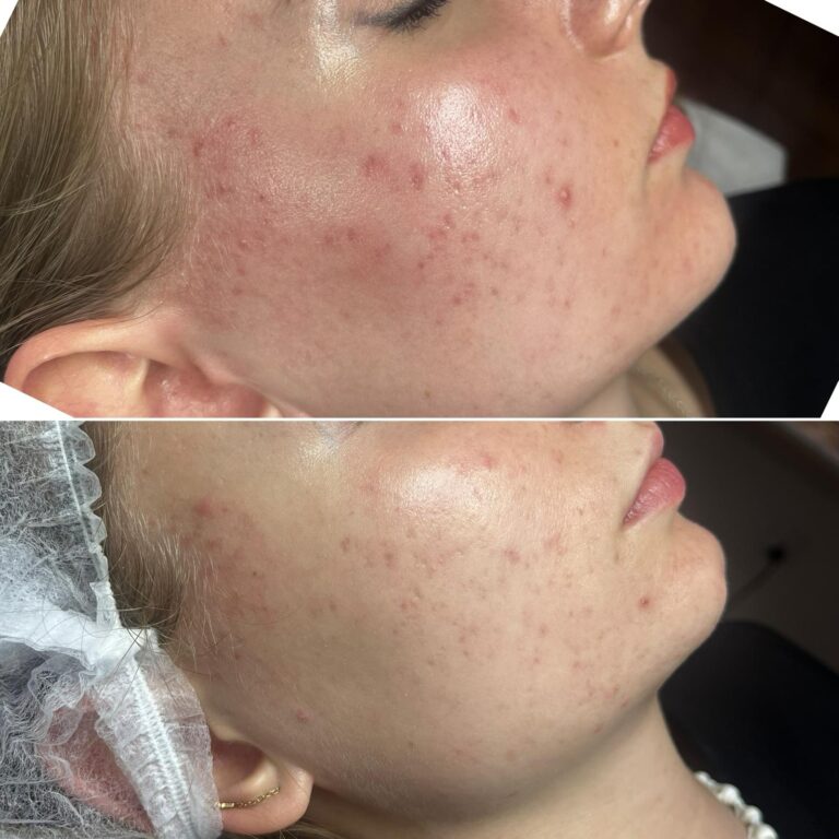 Zdjęcie WhatsApp 2025-09-15 o 13.50.11_a36b7401