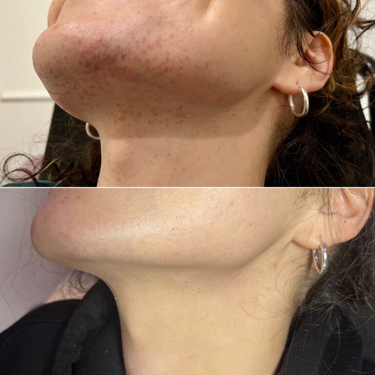 Zdjęcie WhatsApp 2025-09-15 o 13.50.12_5aa7d348